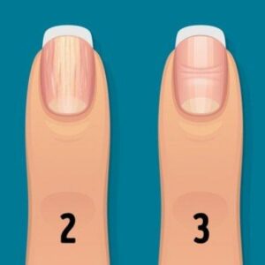 Terbuat Dari Zat Apakah Kuku Pada Makhluk Hidup Ternyata Sama Seperti Rambut
