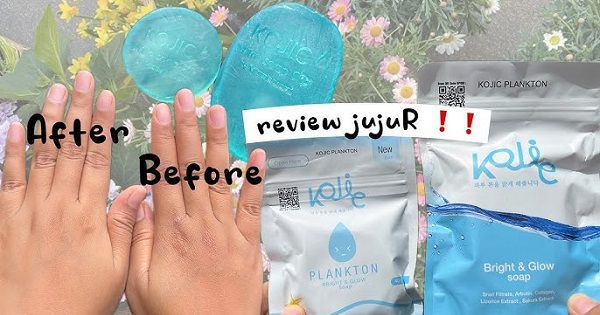 kenali sinyal bahaya dari kulit anda 7 ciri ciri tidak cocok memakai sabun kojic plankton