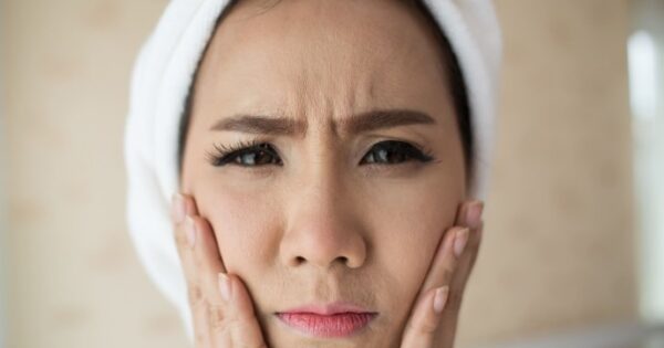 Waspada! Ini 7 Ciri-Ciri Tidak Cocok Memakai Sabun Kojic Plankton yang Wajib Anda Kenali